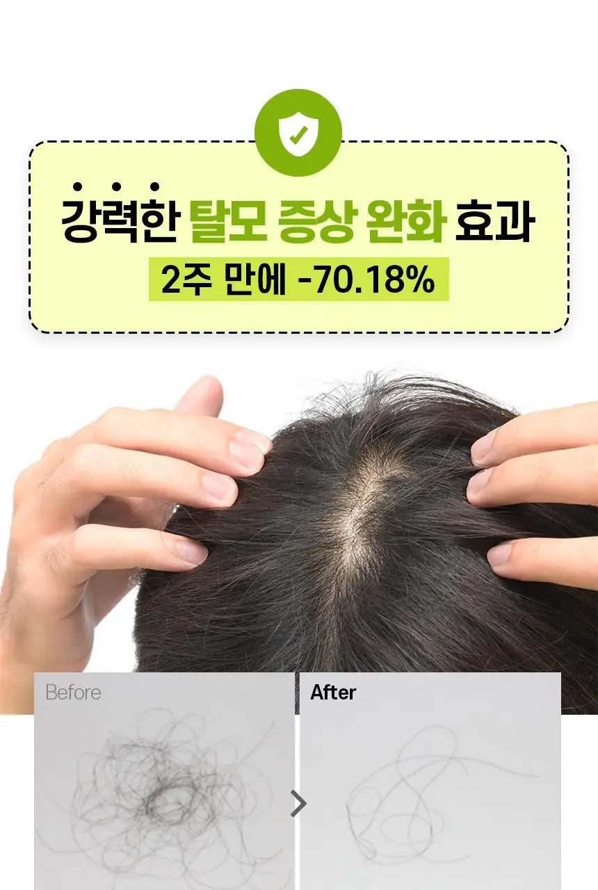 [카이스트특허기술] 그래비티 헤어리프팅 샴푸 엑스트라스트롱 475ml 리필 상세페이지 13